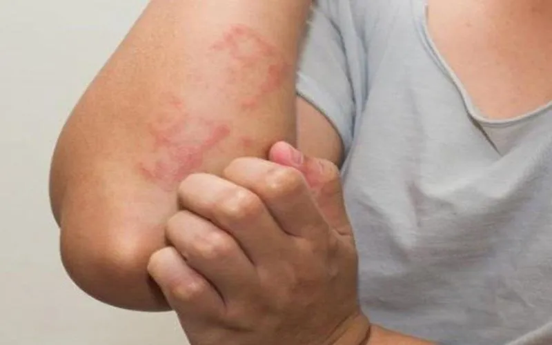 Tác Hại Của Vải Đay Kém Chất Lượng
